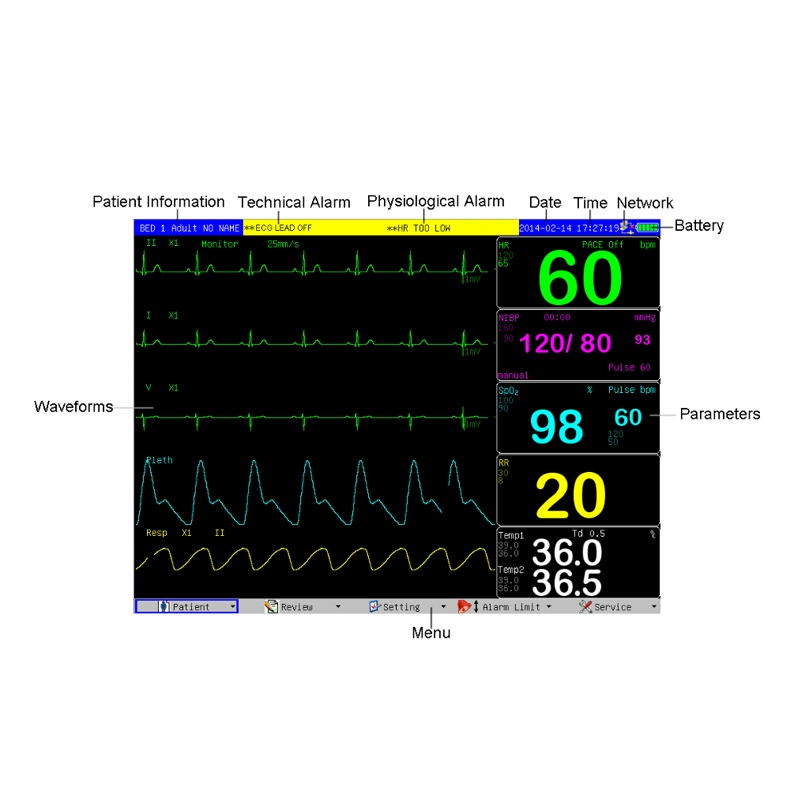 Medical Portable Cheap Multi-Parameter Patient Monitor Device