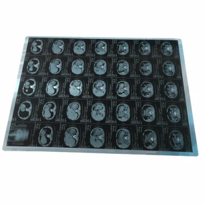 Ecografía Hospital Digital blanco seco de la Luz Solar Films