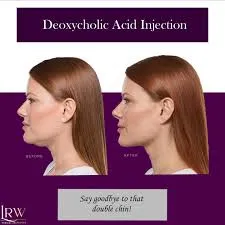 Belkyra Injectable Kybella Injectable Is a Safe Injectable Substance to Reduce and Possibly Eliminate Excess Fat Under The Chin Double Chin