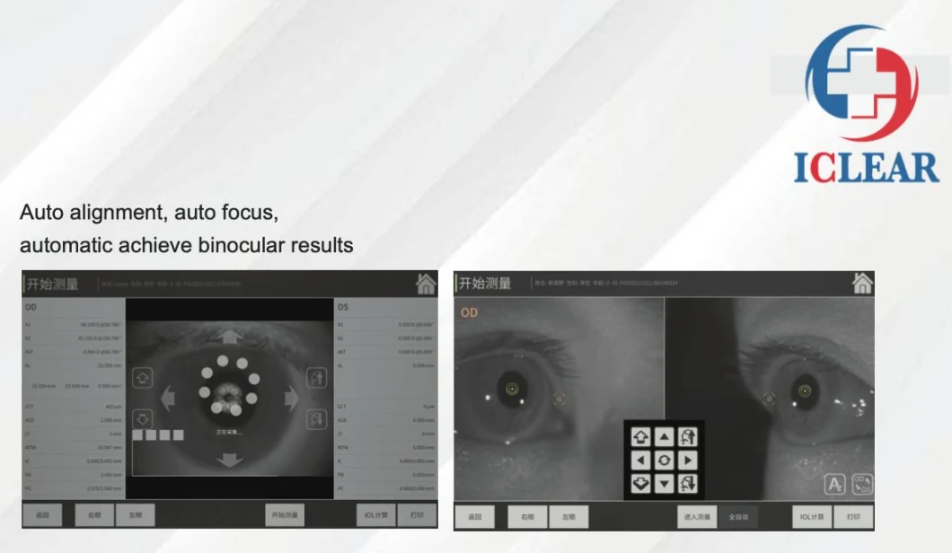 Olcr Optical Ophthalmic Biometer for Eye Axial Length View