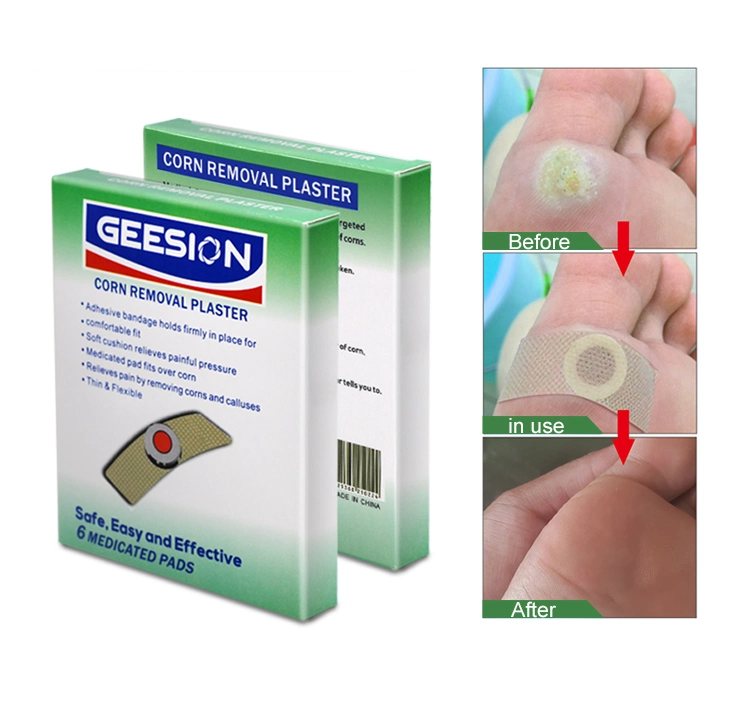 High Quality Best Selling Products Foot Warts Plaster Callus and Corn Removal Patch