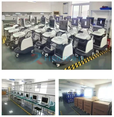 High-End Trolley Ultrasound 4D Dopper Ultrasound Scanner Machine for Abdomen Obstetrics