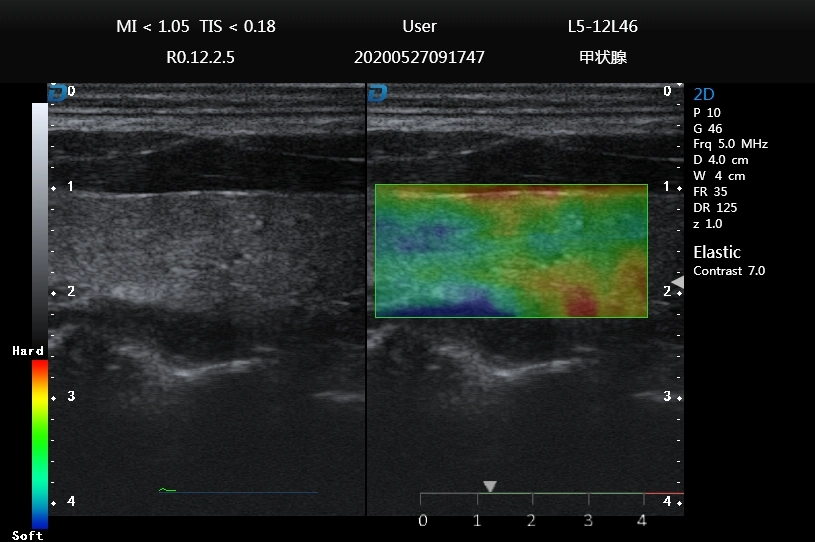 Ultrasound Scanner Color Dopper Portable Cardiac Ultrasound Dw-P60