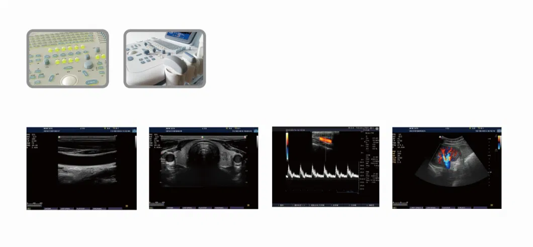 High-End Trolley Ultrasound 4D Dopper Ultrasound Scanner Machine for Abdomen Obstetrics