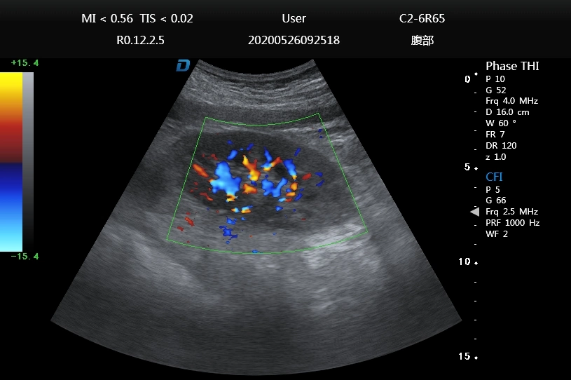 Ultrasound Scanner Color Dopper Portable Cardiac Ultrasound Dw-P60