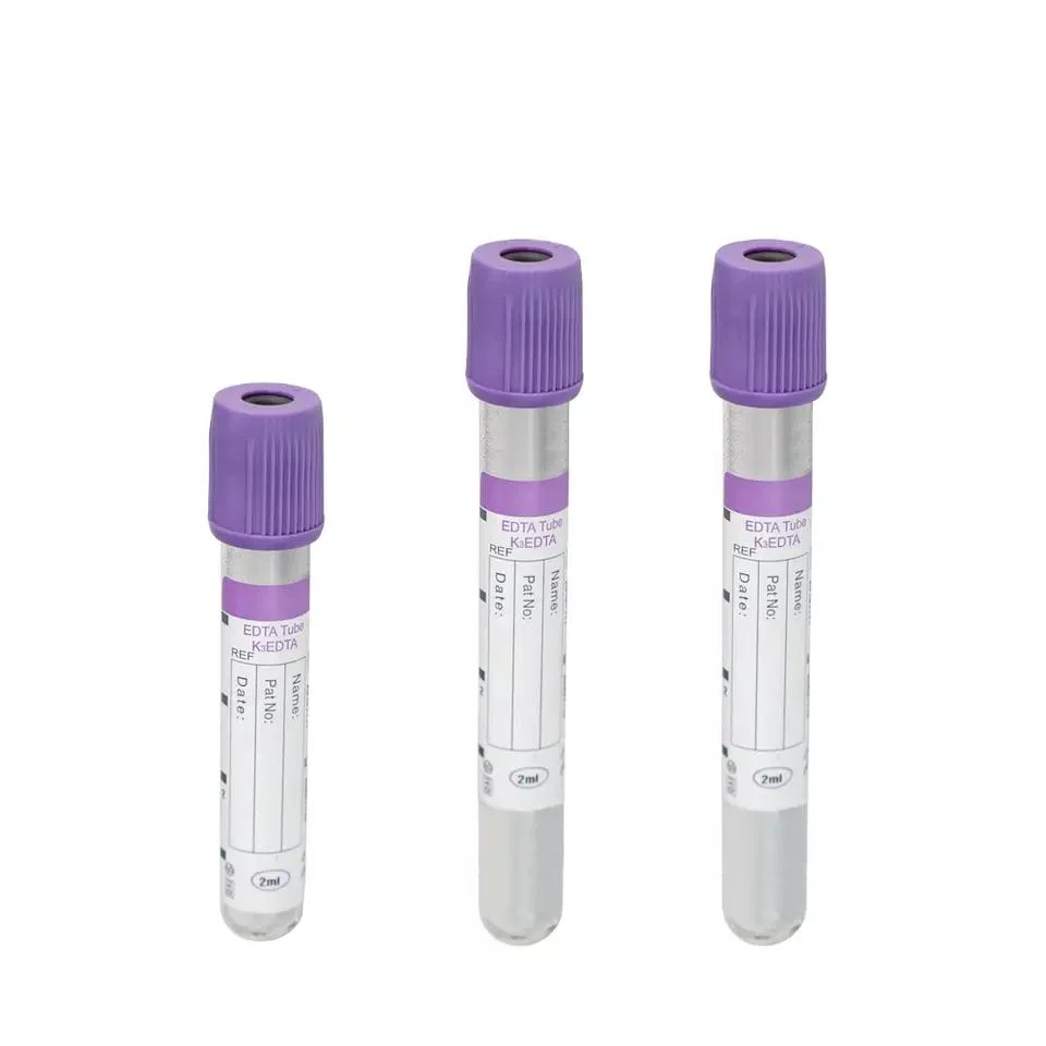 Medical Gel and Clot Activator Tube with Yellow Cap Sst Tube
