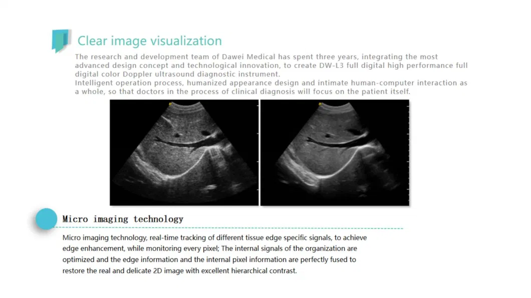 Dawei Dw-L3 Laptop Color Dopper Ultrasound Machine Portable CE ISO