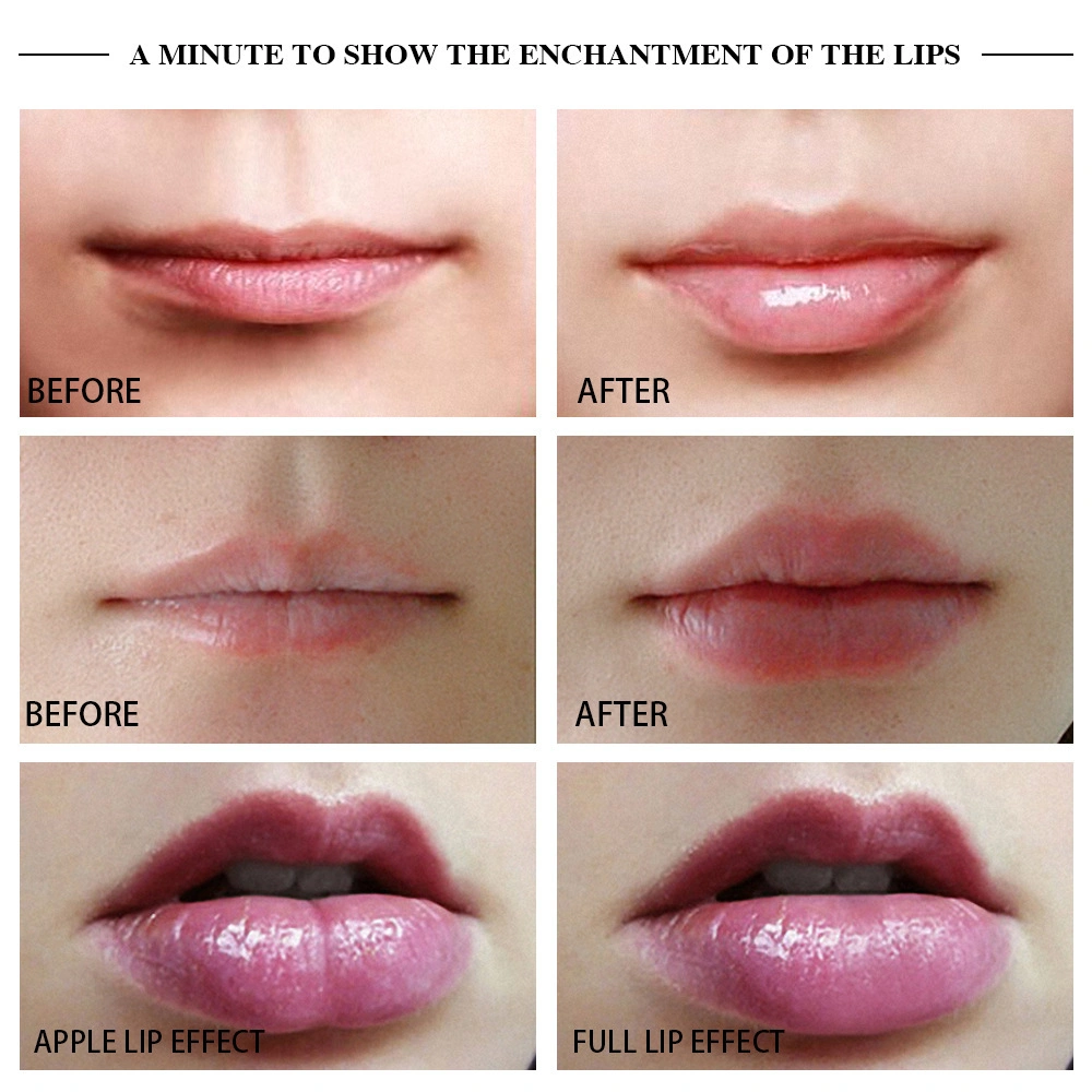 Lip Enhancer Plumper Beauty Enlarge Mouth Lips Enlargement Pump Plumping Bigger Lips Device