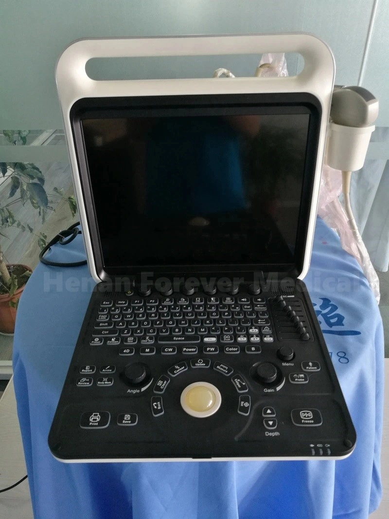 CE Approved Medical Ultrasound Machine Portable Color Doppler Full Digital Ultrasound Scanner