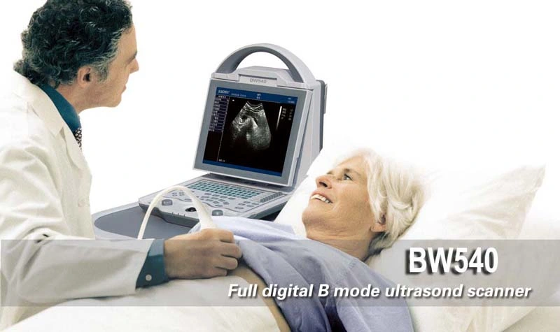 Price for Portable Ultrasound, Pregnancy Scanner Ultrasound, Ultrasound Scan Machine Echographe Dopper, Ultrasound Probe