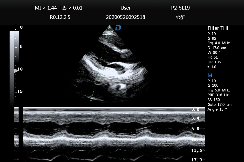 Ultrasound Scanner Color Dopper Portable Cardiac Ultrasound Dw-P60