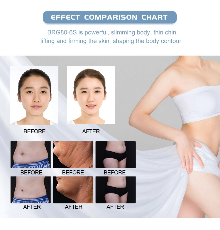 6 Handles Criolipolysis Vacuum Lifting Body Contouring Slimming Equipment Fat Freeze Machine Liposuction Criolipolisis Fats Freezing