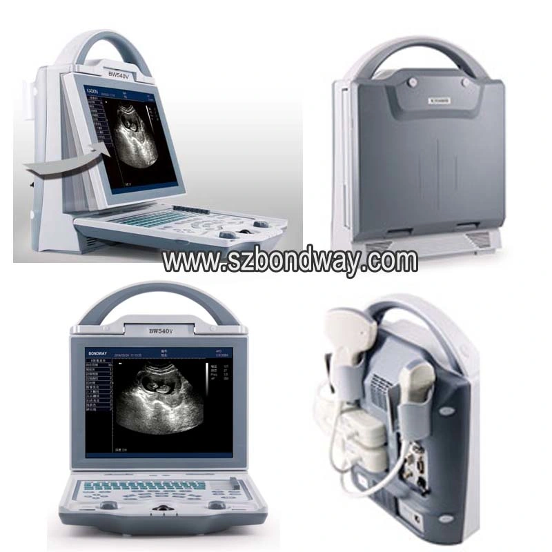 Medical Equipment Veterinary Ultrasound Scanner, Veterinary Color Doppler Ultrasound, Ultrasonic Transducer Price, USG, Bcf, Reproscan Vet Ultrasound