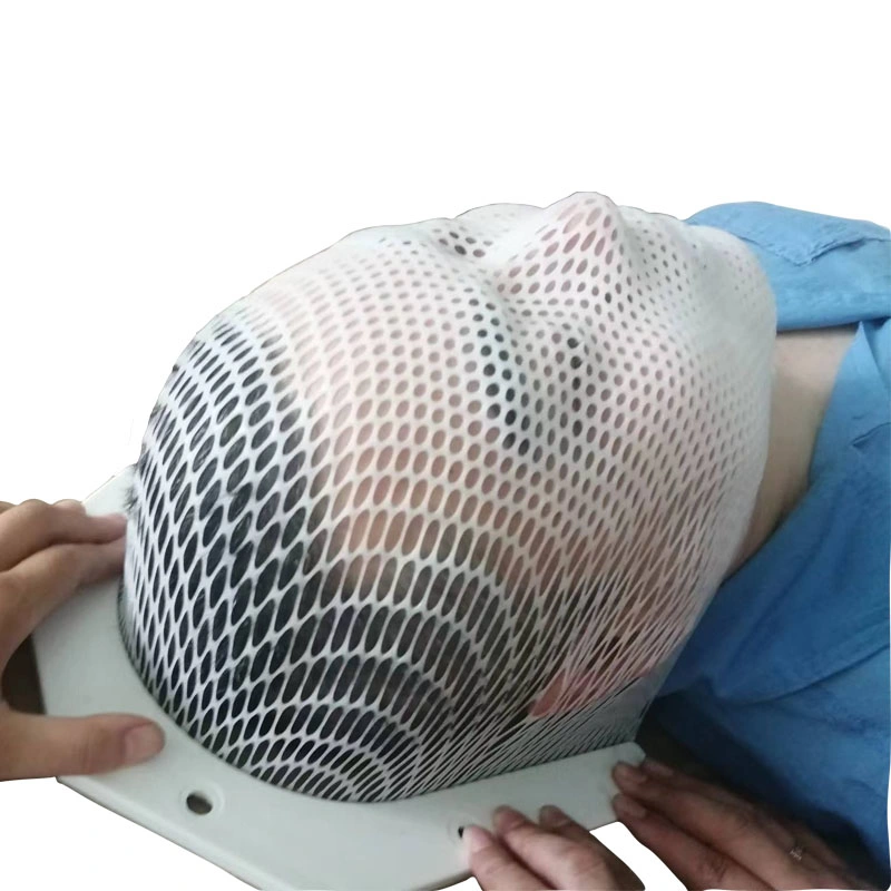 Radiation Therapy U-Frame Head Mask for Brain Cancer Patient Fixation and Immobilization