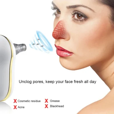 Aspirapolvere viso elettrico con pulitore per pelli nere Acne Remover Pore Strumento di pulizia