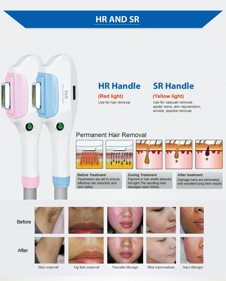 Hot Sale 2 Handles Magnetic-Optical IPL Hair Removal Machine