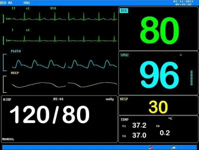 Factory Price Multi-Parameter ICU Portable Patient Monitor