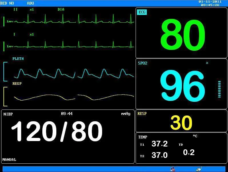 Ks5000 Medical Multi-Parameter Portable Patient Monitor Supplier for ICU Room