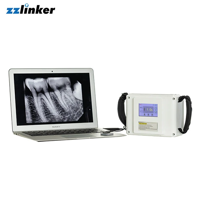 Lk-C65A Handy Dental Equipment Xray Sensor Digital X-ray Sensor Hdr 500A with CE