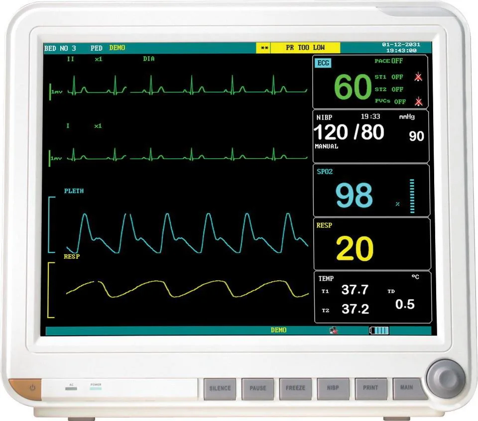 Ks5000 Medical Multi-Parameter Portable Patient Monitor Supplier for ICU Room