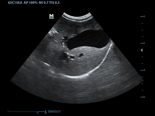 Mindray Vet Ultrasound Dp 50 Mindray Veterinary Ultrasound Portable Color Doppler Mindray Ultrasonic Scanner Dp50 Vet Machine