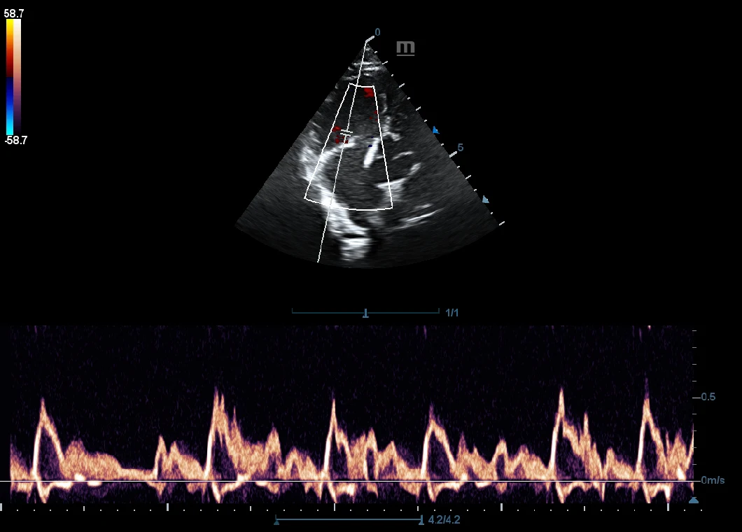 Mindray Vet Ultrasound Dp 50 Mindray Veterinary Ultrasound Portable Color Doppler Mindray Ultrasonic Scanner Dp50 Vet Machine