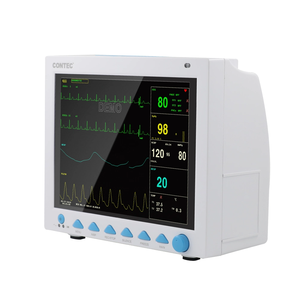 Portable 5-Inch Touch Screen Veterinary Multiparameter Monitor