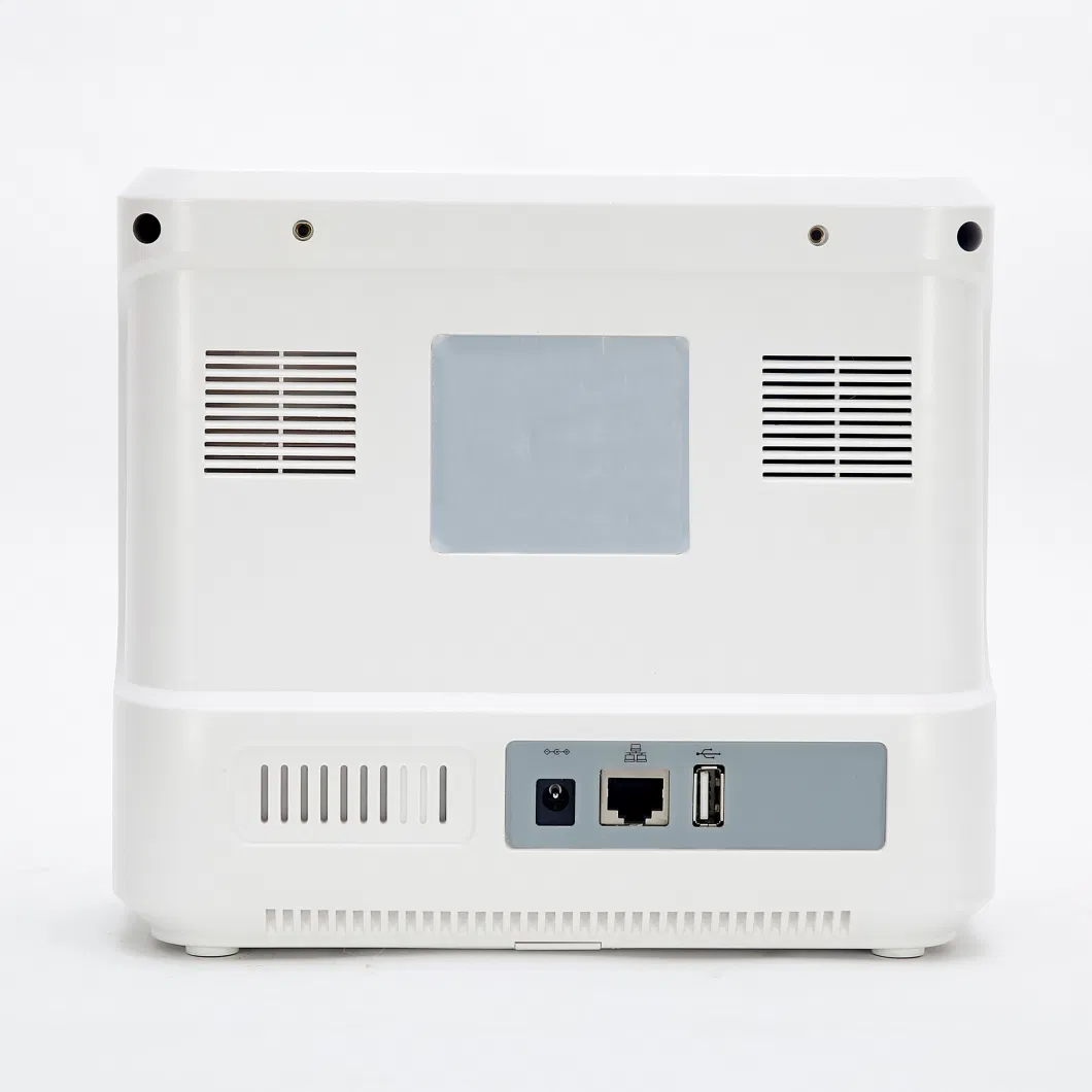 Multiparameter Vitals Monitor Machine in Hospital Room