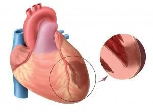 Portable Arteriosclerosis Detector for Comprehensive Evaluation of Arterial Elastic Function and Myocardial Oxygen Supply and Demand