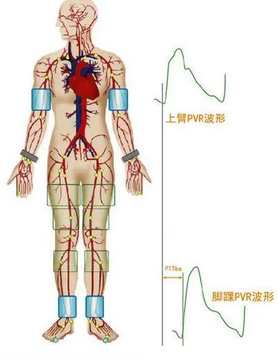Portable Arteriosclerosis Detector for Comprehensive Evaluation of Arterial Elastic Function and Myocardial Oxygen Supply and Demand
