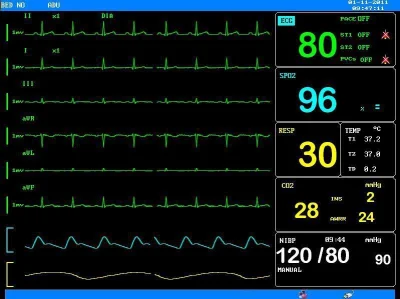 Prezzo di fabbrica Monitor paziente portatile per terapia intensiva multiparametro