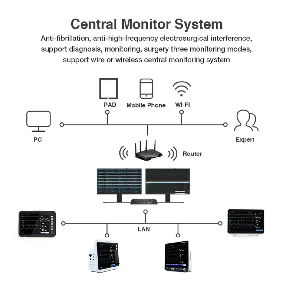 Medical Patient Monitor High Quality Vital Signs Monitor for Hospital Clinic Rooms