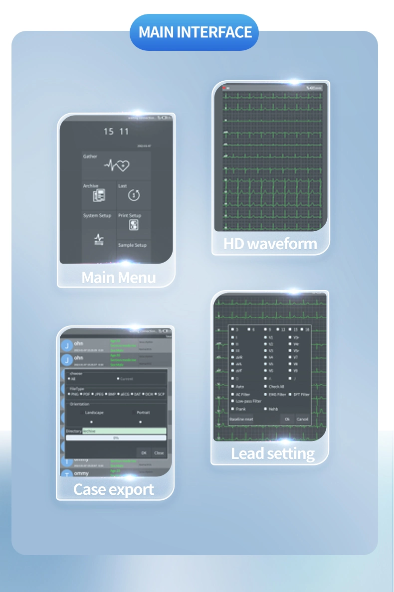 Manufacturer Contec Digital Touch Screen Electrocardiograph Monitor ECG Machine