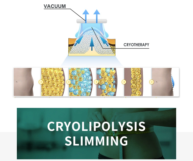 Vertical Cool Tech Cryolipolysie 4 Cryo Handles Cryolipolysis Body Shaping Slimming Machine