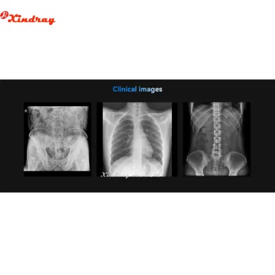 Animal Hospital utilizzare Medical Portable Exposure Programs X-ray Machine per Cane da gatto Cavallo