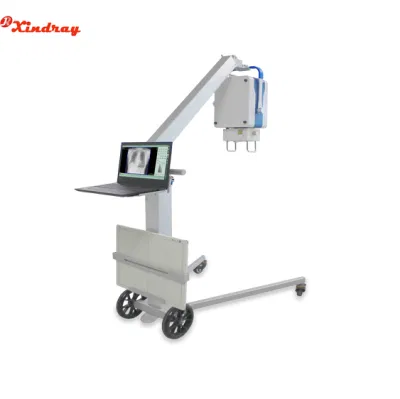 Macchina radiologica per carrello mobile medico con pannello metallico opzionale Scatola di rinvio