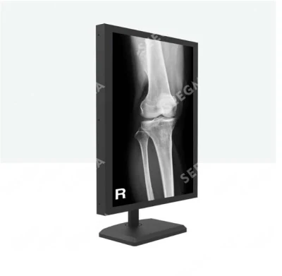 MRI Nuclear Medicine Digital Mammography Dr 5MP Medical Diagnostic Display