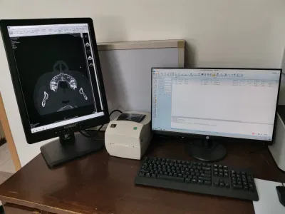 MRI Nuclear Medicine Digital Mammography Dr 5MP Medical Diagnostic Display