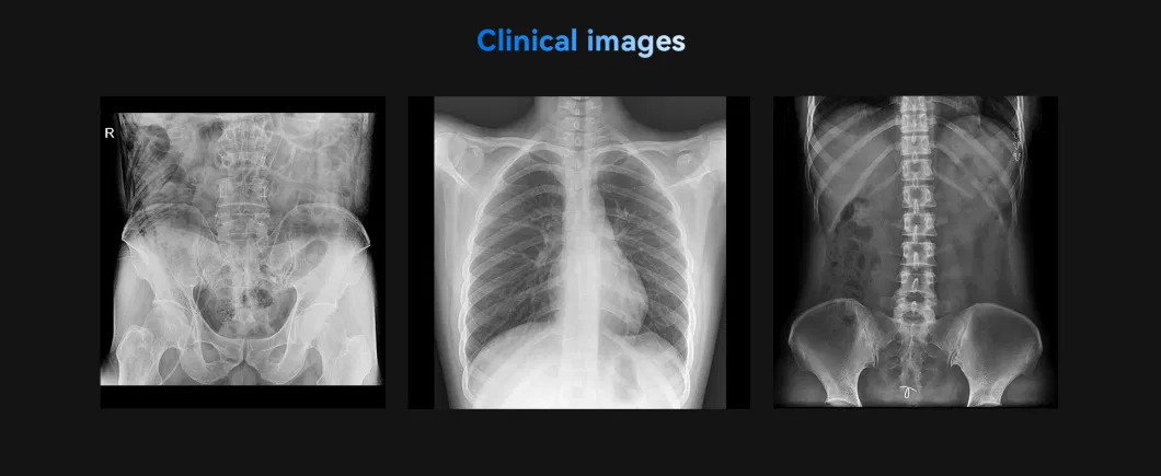 Factory Price Digital Radiography Mobile High Frequency X-ray 4kw 5kw 200mA 100mA Mini Portable X Ray Machine with Dr System