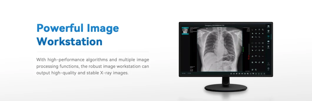 Hospital Equipment 100mA Veterinary X-ray with Panel Software for Convenient Operation