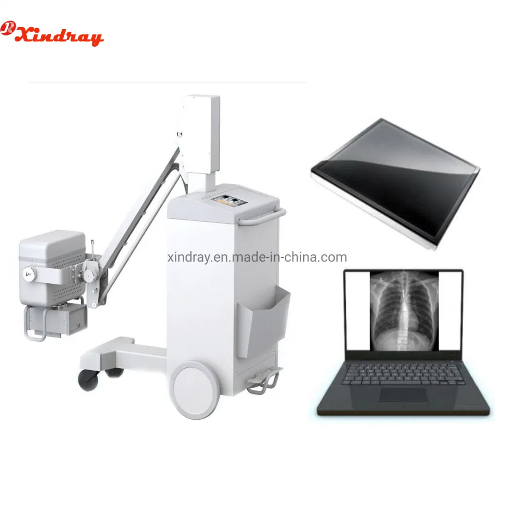 Factory Price Hospital Equipment High Frequency Digital Radiography Portable Medical X Ray 100mA 200mA 500mA 5kw 20kw 32kw Mobile X-ray Machine
