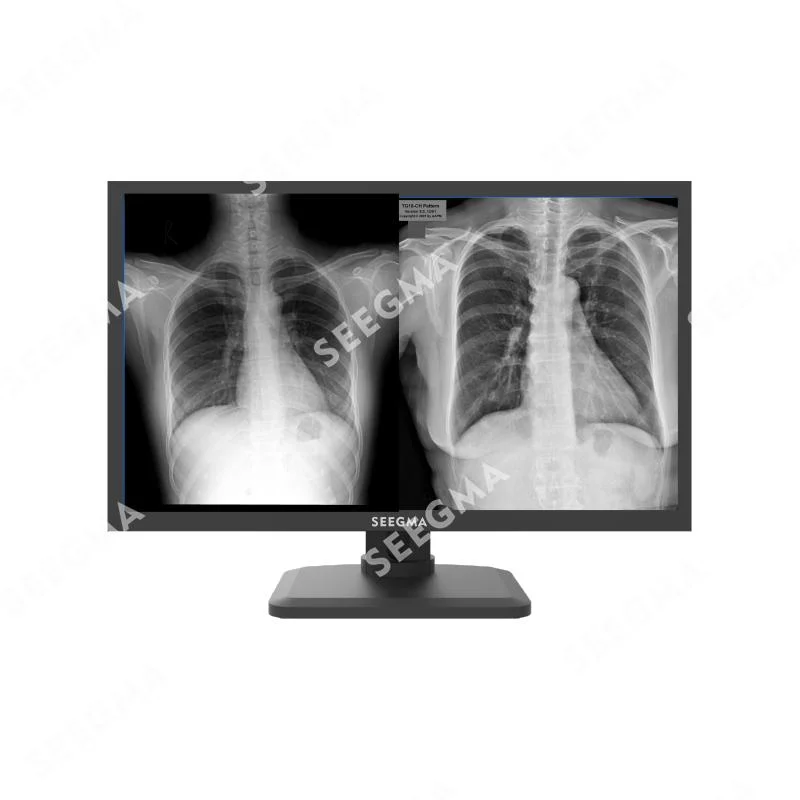 MRI Nuclear Medicine Digital Mammography Dr 5MP Medical Diagnostic Display