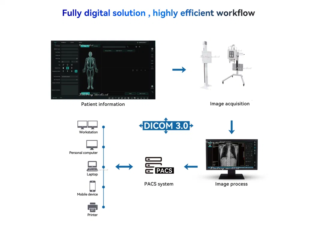 Hospital Equipment 100mA Veterinary X-ray with Panel Software for Convenient Operation