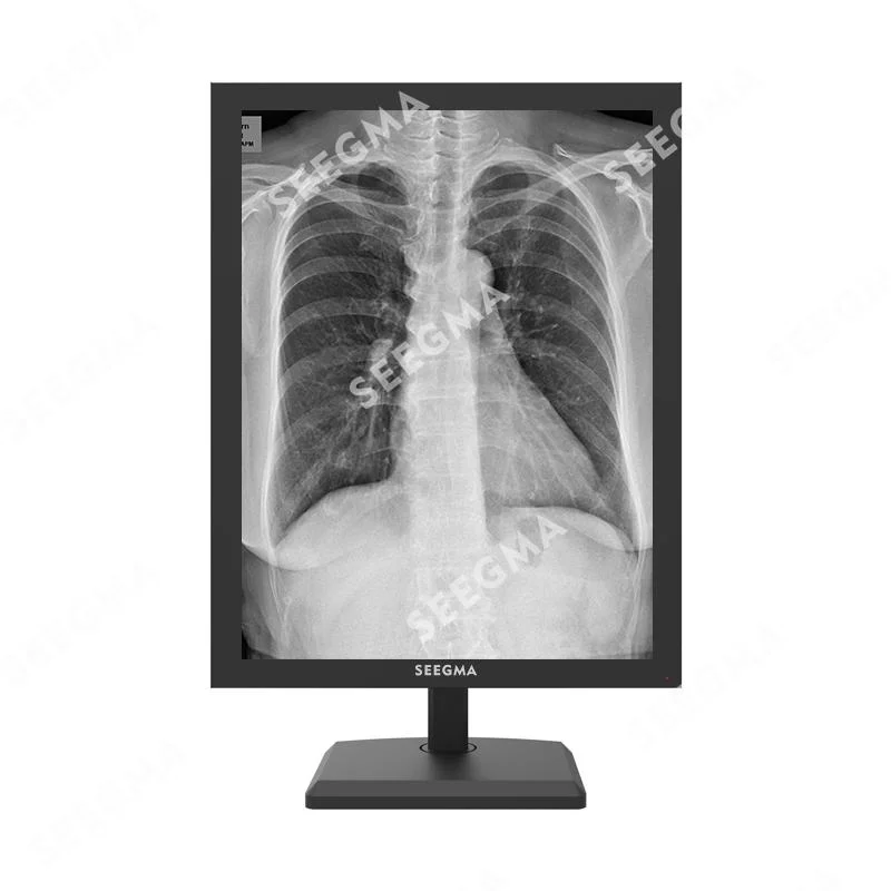 MRI Nuclear Medicine Digital Mammography Dr 5MP Medical Diagnostic Display