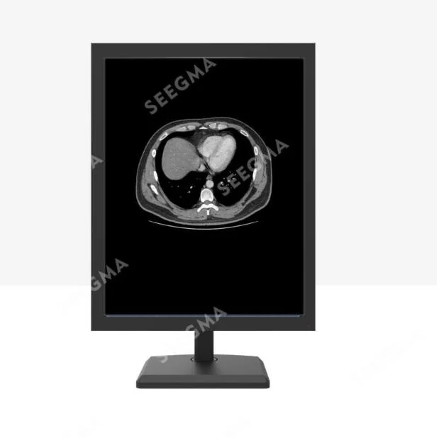 MRI Nuclear Medicine Digital Mammography Dr 5MP Medical Diagnostic Display