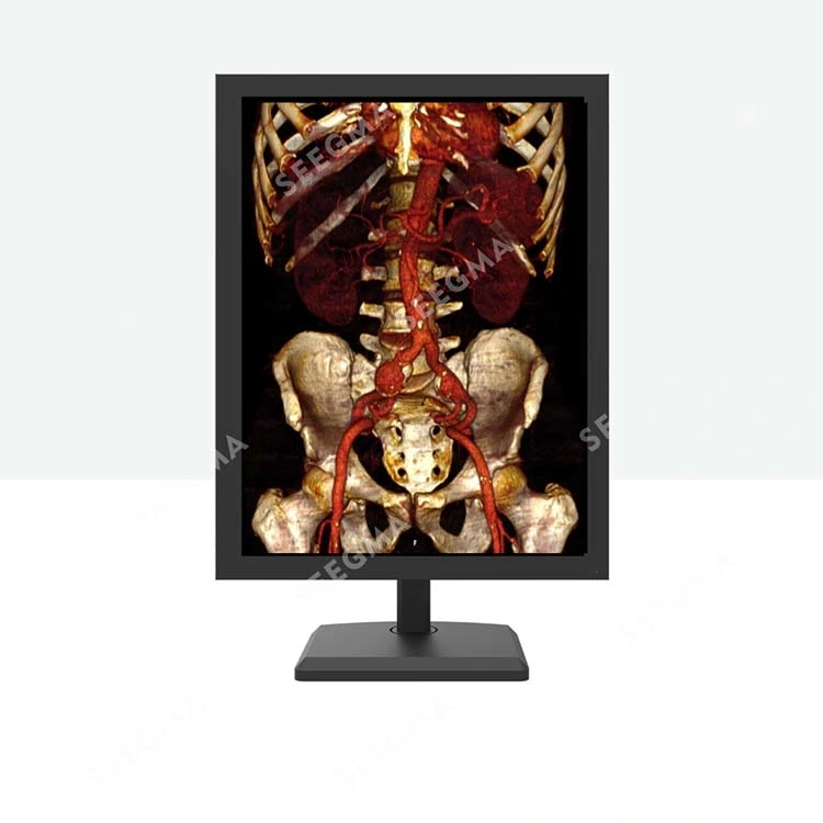 MRI Nuclear Medicine Digital Mammography Dr 5MP Medical Diagnostic Display