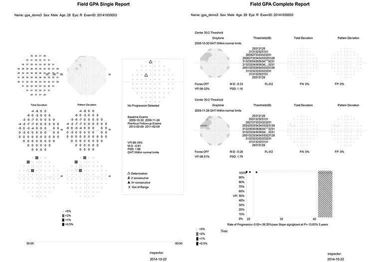 Projection Perimeter, Humphrey Type Perimeter, Visual Field Analyzer