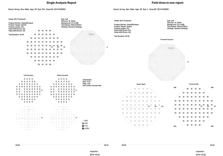 Projection Perimeter, Humphrey Type Perimeter, Visual Field Analyzer