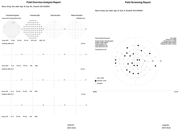 Projection Perimeter, Humphrey Type Perimeter, Visual Field Analyzer