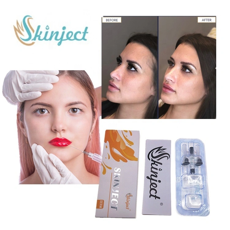 Skinject 2ml Derm Ha Injectable Hyaluronic Acid Dermal Fillers for Face